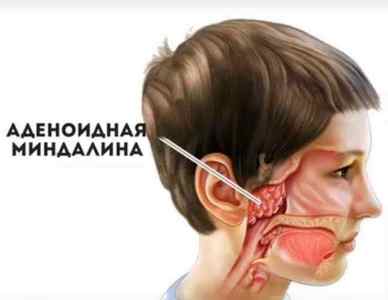 Захворювання органів дихання у дітей: симптоми, лікування, профілактика