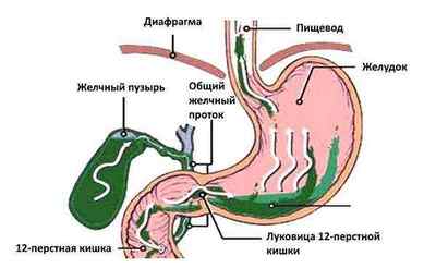 Закид кислоти з шлунку в стравохід: причини, симптоми, лікування, діагностика