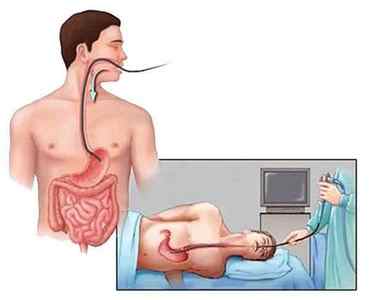Закид кислоти з шлунку в стравохід: причини, симптоми, лікування, діагностика