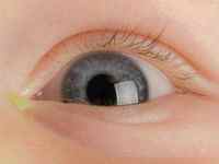 Закисають очі у дитини або дорослої людини: причини, що робити, як лікувати закисания