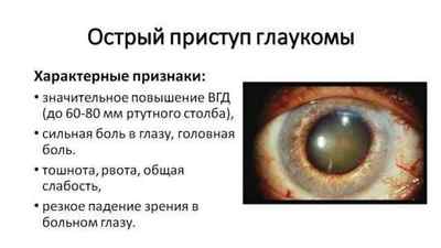 Закритокутова глаукома: причини, симптоми, лікування і профілактика гострих нападів