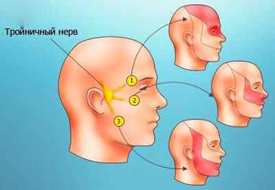 Запалення трійчастого нерва: симптоми і лікування