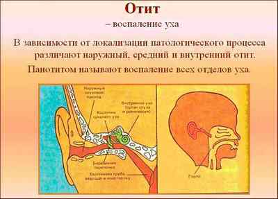 Запалення вуха: причини, симптоми і лікування
