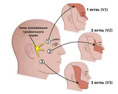 Защемлення лицьового нерва: симптоми і лікування