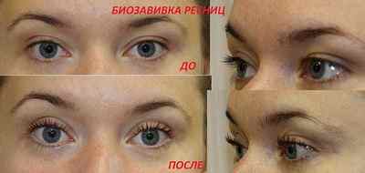 Завивка вій (хімічна): фото до і після, відгуки, як користуватися хім-завивкою