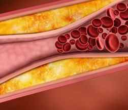 Зниження рівня холестерину в крові: найефективніші методи