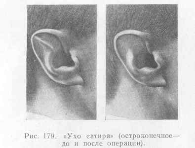 Зовнішнє вухо: будова, функції, можливі захворювання