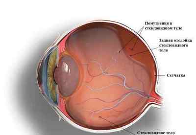 Зірочки в очах: причини, характерні симптоми, чому зявляються