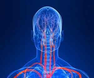 Звивистість хребетних артерій: симптоми і лікування, що таке, як лікувати вроджену звивистість | Ревматолог